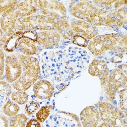 ECE1 antibody