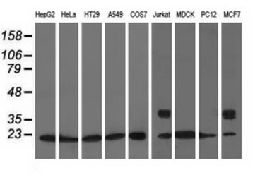 Rho GDI alpha antibody [1F2]