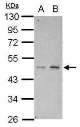 HTRA3 antibody