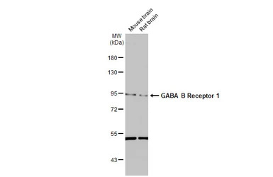 GABA B Receptor 1 antibody [N2