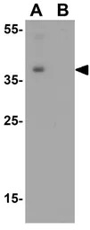 SAE1 antibody