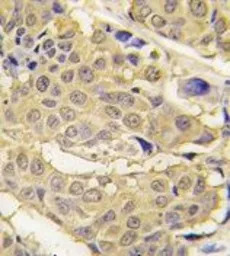 EPRS antibody, N-term