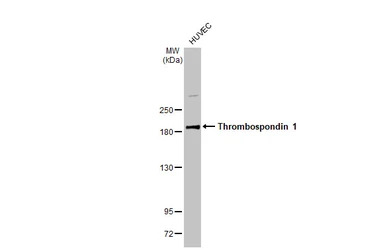 Thrombospondin 1 antibody