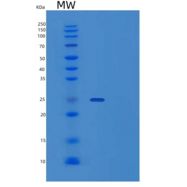 人泛素羧基末端水解酶同工酶L1/UCH-L1重组蛋白C-6His