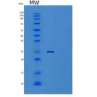 人泛素羧基末端水解酶同工酶L1/UCH-L1重组蛋白C-6His