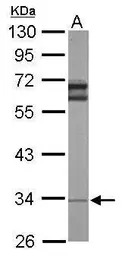 RPL5 antibody