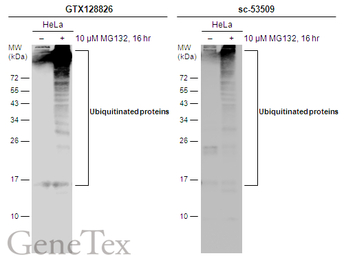 Ubiquitin antibody
