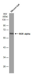 ROR alpha antibody [C3], C-ter