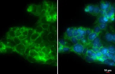 CXCR5 antibody [C1C2], Interna