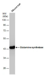 Glutamine synthetase antibody 