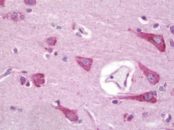 Apelin Receptor antibody