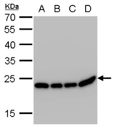 SOD2 antibody [GT17112]