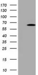 Pyruvate Kinase (liver/RBC) an
