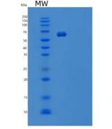 小鼠白细胞介素1受体1型/白细胞介素1R-1重组蛋白