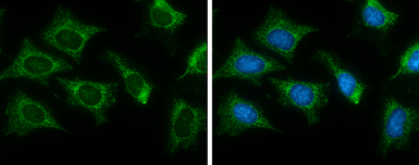 Citrate synthase antibody [GT2