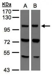 VPS11 antibody