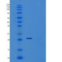 人RANK/TNFRSF11A/CD265重组蛋白(C-6His)