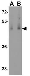 BMP15 antibody