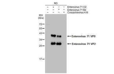 Enterovirus 71 VP2 antibody