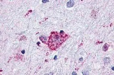 Glucagon like peptide 2 recept