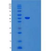 人骨形态发生蛋白受体IA/ALK-3/CD292重组蛋白