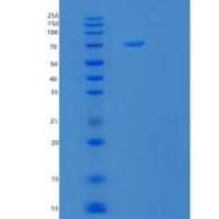 人转铁蛋白(TF)重组蛋白