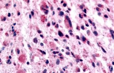 GABA B Receptor 1 antibody