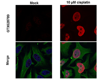 Histone H2A.XS139ph (phospho S