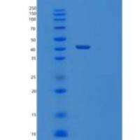 人泛素结合酶E2 I重组蛋白