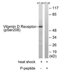 Vitamin D Receptor (phospho Se