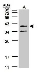 GALR2 antibody