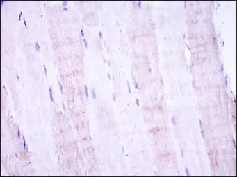 SEK1 / MKK4 antibody [5H4]