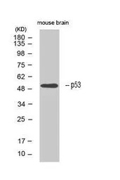 p53 antibody