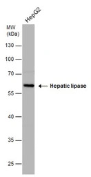 Hepatic lipase antibody [N1C1]