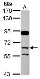 CFHR5 antibody