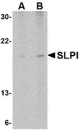 SLPI antibody