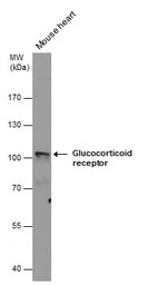 Glucocorticoid Receptor antibo