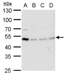 TIPIN antibody