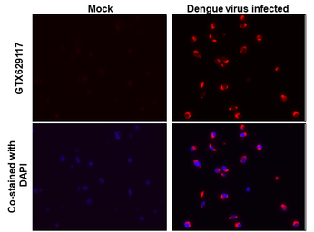 Dengue virus Envelope protein 