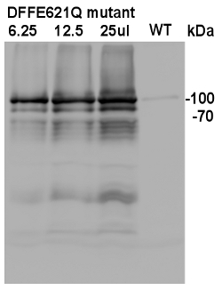 western blot using anti-HA tag antibody on plant recombinant protein