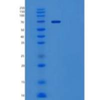 小鼠酪氨酸蛋白激酶受体酪氨酸3/DTK(C-Fc)重组蛋白