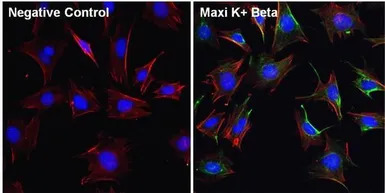 KCNMB1 antibody