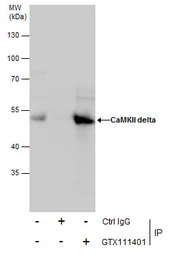 CaMKII delta antibody