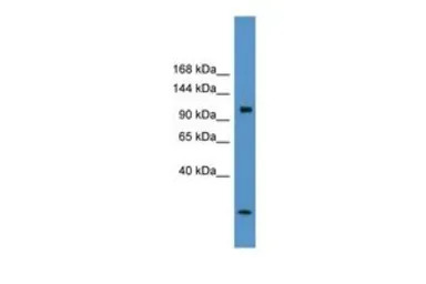 CLCN1 antibody, C-term