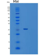 人Sentrin特异性蛋白酶8/SENP8重组蛋白N-6Hi