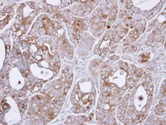 MAP3K8 antibody [N3C3]