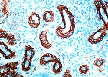 Muscle Actin antibody [1A4+5C5