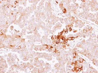 Alpha 2 Antiplasmin antibody [