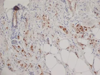 Progesterone Receptor antibody