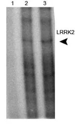 LRRK2 antibody